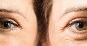 Toulouse centre de la face chirurgie orbito-palpébrale
